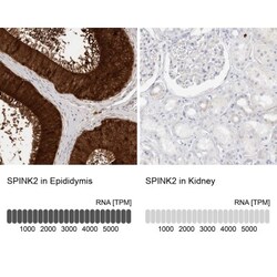 SPINK2 Antibody, Novus Biologicals:Antibodies:Primary Antibodies